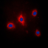 GRB10 (Phospho-Y67) Rabbit Polyclonal Antibody