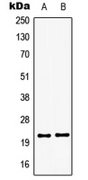GSC2 Rabbit Polyclonal Antibody