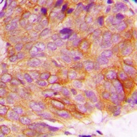 GSK3 alpha (Phospho-S21) Rabbit Polyclonal Antibody