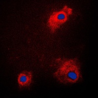 GSK3 alpha (Phospho-S21) Rabbit Polyclonal Antibody