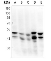 GSK3 alpha/beta Rabbit Polyclonal Antibody