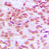 GSK3 alpha/beta Rabbit Polyclonal Antibody