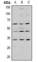 GSK3 beta (Phospho-S9) Rabbit Polyclonal Antibody