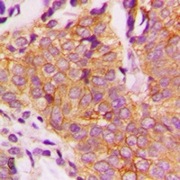 GSK3 beta (Phospho-S9) Rabbit Polyclonal Antibody