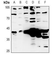 Granzyme B/H Rabbit Polyclonal Antibody