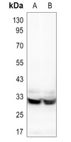 HCCS Rabbit Polyclonal Antibody