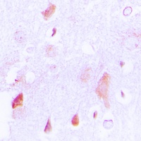 HCCS Rabbit Polyclonal Antibody