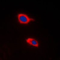 HCCS Rabbit Polyclonal Antibody