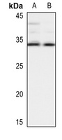 HLA-DOB Rabbit Polyclonal Antibody