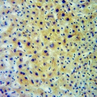 HLA-DOB Rabbit Polyclonal Antibody