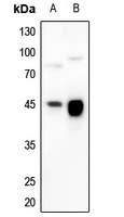HLA-G Rabbit Polyclonal Antibody