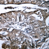 HLA-G Rabbit Polyclonal Antibody