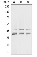 hnRNP A1 Rabbit Polyclonal Antibody