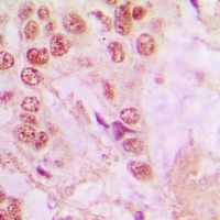 hnRNP A1 Rabbit Polyclonal Antibody