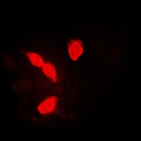 hnRNP A1 Rabbit Polyclonal Antibody