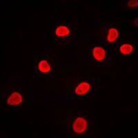 hnRNP F Rabbit Polyclonal Antibody