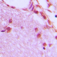 hnRNP H Rabbit Polyclonal Antibody