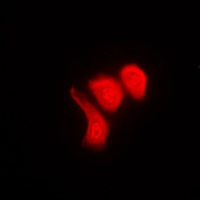 hnRNP K (Phospho-S284) Rabbit Polyclonal Antibody