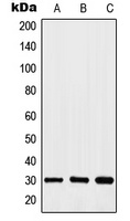 HOXA11/D11 Rabbit Polyclonal Antibody