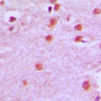 HOXA11/D11 Rabbit Polyclonal Antibody