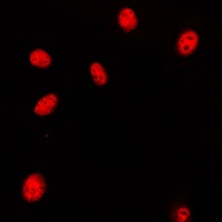 HOXA11/D11 Rabbit Polyclonal Antibody