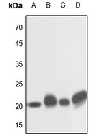 NRAS/HRAS/KRAS Rabbit Polyclonal Antibody