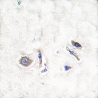 NRAS/HRAS/KRAS Rabbit Polyclonal Antibody