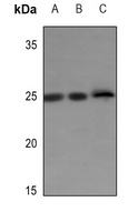 ERAS Rabbit Polyclonal Antibody