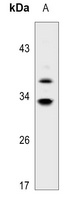 HSD11B1 Rabbit Polyclonal Antibody