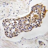 HSD11B1 Rabbit Polyclonal Antibody