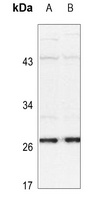 HSP27 (Phospho-S15) Rabbit Polyclonal Antibody