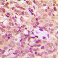 HSP27 (Phospho-S15) Rabbit Polyclonal Antibody