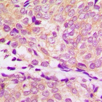 HSP90 alpha Rabbit Polyclonal Antibody