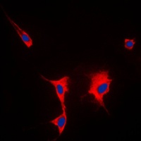 HSP90 alpha Rabbit Polyclonal Antibody