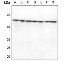 HSP60 Rabbit Polyclonal Antibody