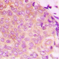 HSP60 Rabbit Polyclonal Antibody