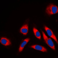 HSP60 Rabbit Polyclonal Antibody