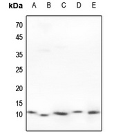 HSPE1 Rabbit Polyclonal Antibody