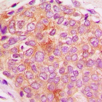 HSPE1 Rabbit Polyclonal Antibody