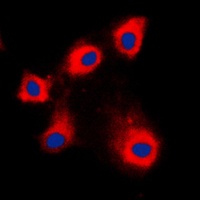 HSPE1 Rabbit Polyclonal Antibody