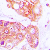 HSP40 Rabbit Polyclonal Antibody