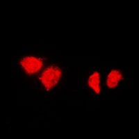 HSP40 Rabbit Polyclonal Antibody