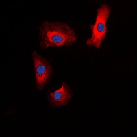 Amylin Rabbit Polyclonal Antibody