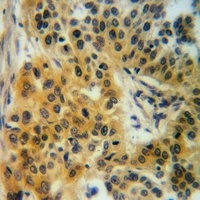 Factor I Rabbit Polyclonal Antibody
