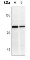 IFNGR1 (Phospho-Y457) Rabbit Polyclonal Antibody