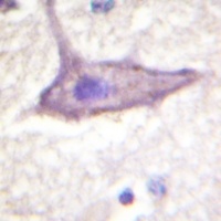 IFNGR1 (Phospho-Y457) Rabbit Polyclonal Antibody