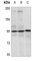 IGF1 Receptor (Phospho-Y1165/Y1166) Rabbit Polyclonal Antibody