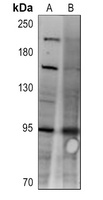IGF1 Receptor Rabbit Polyclonal Antibody