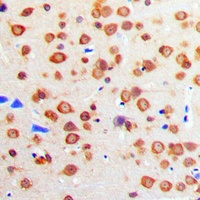 IGF1 Receptor Rabbit Polyclonal Antibody