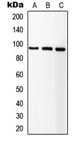 IGF1 Receptor Rabbit Polyclonal Antibody